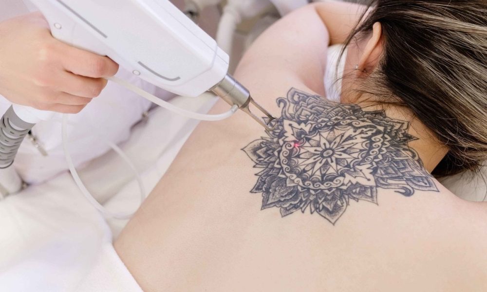 Enhance Your Appearance in Dubai: Fillers and Tattoo Removal